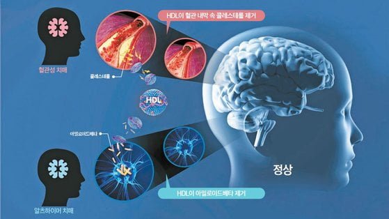 뇌